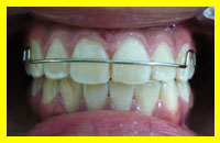 medium2 ortodoncia<pre></pre>
