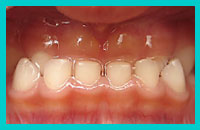 medium2 ortopedia dentofacial