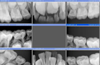 medium2 radiografias