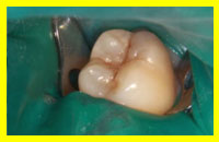 medium2 resinas